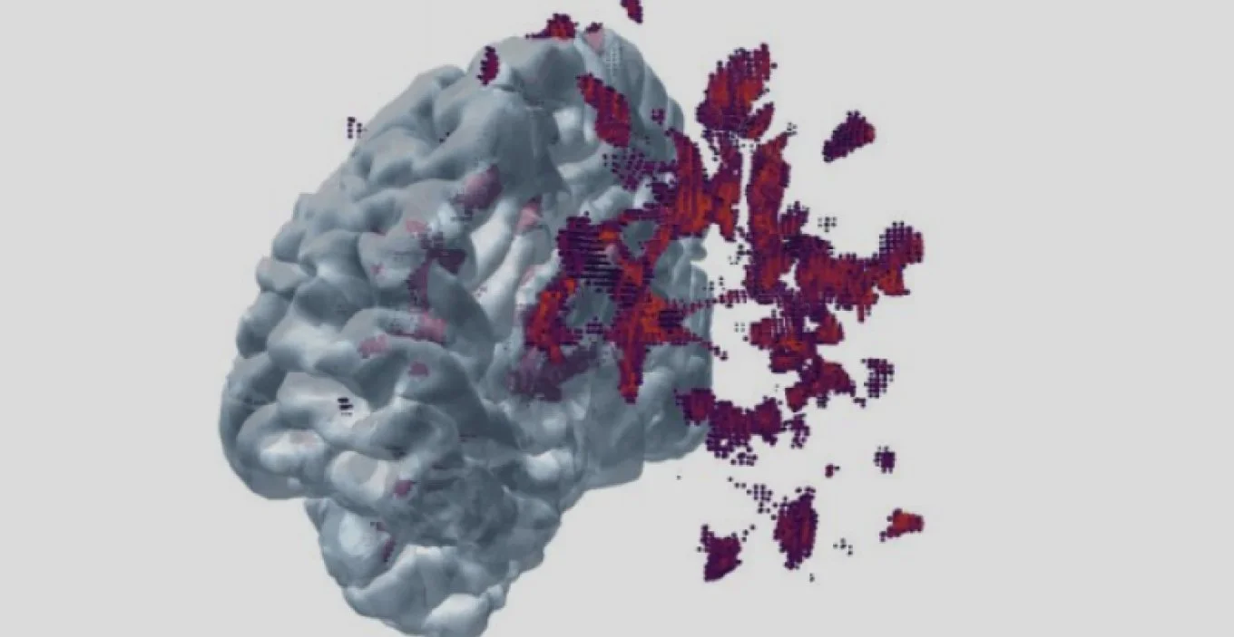 A computer-generated image of a human brain with colored pixelated areas indicating data or activity spread across one side.
